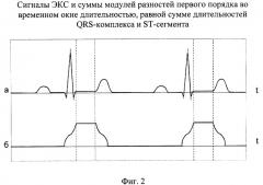 Способ выделения st-сегмента электрокардиосигнала в реальном времени и устройство для его осуществления (патент 2261653)