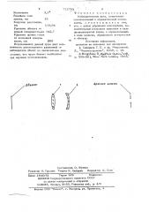 Наблюдательная лупа (патент 712793)