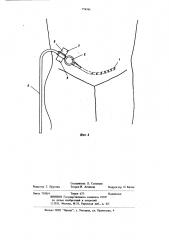Дренаж для брюшной полости (патент 774561)