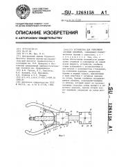 Устройство для репозиции костных отломков (патент 1268158)