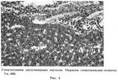 Способ получения метастазов печени в эксперименте (патент 2538243)