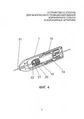 Устройство и способ для безопасного позиционирования коронарного стента в коронарных артериях (патент 2661092)