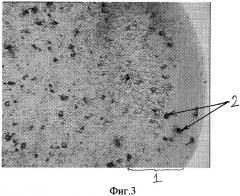 Способ прижизненного определения вида органических камней желчного пузыря (патент 2299436)