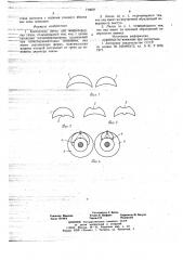 Контактная линза для микрохирургии глаза (патент 719627)