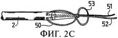 Способ крепления натяжных нитей к концам протезной связки (патент 2370243)
