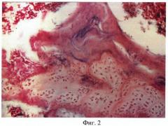 Способ изменения структуры костной ткани при экспериментальном стероидном остеопорозе (патент 2371189)