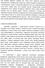 Способ лечения путем подкожной подачи пониженного давления с использованием разделения с помощью воздушного баллона (патент 2405588)