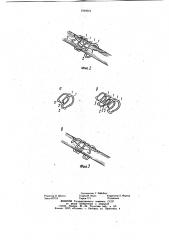 Устройство для остеосинтеза косых и оскольчатых переломов трубчатых костей (патент 1049054)