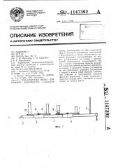 Транспортная шина для нижней конечности (патент 1147392)