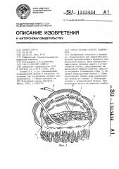 Способ лечения острого панкреатита (патент 1313434)