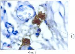 Способ идентификации тучных клеток в гистологическом препарате (патент 2418065)