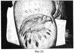 Способ удаления пигментов с пигментированного участка кожи (патент 2375971)
