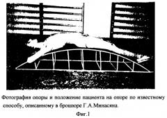 Способ лечения и профилактики заболеваний позвоночника (патент 2252000)
