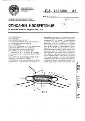 Способ формирования анастомоза полых органов (патент 1351588)