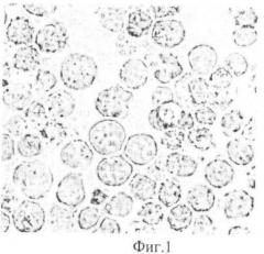 Клеточная линия d11 множественной миеломы человека, используемая для гибридомной технологии (патент 2482181)