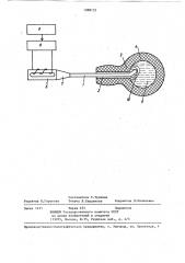 Способ лечения контрактуры шейки мочевого пузыря (патент 1088725)