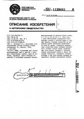 Зонд (патент 1139441)