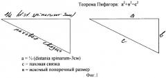 Способ моделирования полипропиленового имплантата, используемого при протезировании передней брюшной стенки у больных с паховыми и бедренными грыжами (патент 2340294)