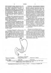 Способ пилоросохраняющей резекции желудка (патент 1639640)