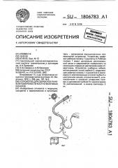 Устройство для обработки раневой поверхности костно- мозговых каналов (патент 1806783)