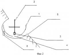 Устройство, отслеживающее вертикальное положение ствола строительного артиллерийского орудия, находящегося на качающейся платформе (патент 2455424)
