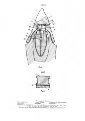 Съемный зубной протез (патент 1463273)