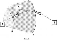 Способ высокоточного поражения радиоэлектронных объектов (патент 2598687)