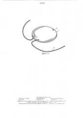 Искусственный хрусталик глаза (патент 1537244)