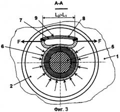 Радиальное уплотнение вала (патент 2267678)