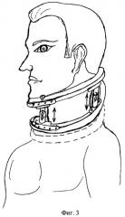 Шина для шейного отдела позвоночника (патент 2444336)