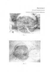 Способ хирургического лечения глубоких кожных дефектов (патент 2622979)