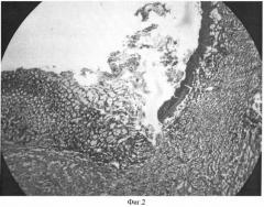 Способ моделирования аутоиммунной язвы желудка у крыс (патент 2362215)