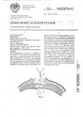 Способ парамедианной лапаротомии (патент 1602476)