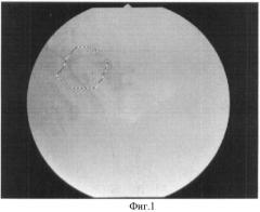 Способ диагностики дистрофических изменений сетчатки на периферии глазного дна (патент 2421121)