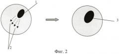 Способ проведения лазерного фотомидриаза (патент 2466700)