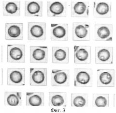 Способ определения уплотненных белково-липидных участков в мембранах эритроцитов различной степени зрелости с помощью компьютерной программы bio vision (патент 2390020)
