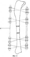 Способ моделирования переломо-дефекта длинной трубчатой кости (патент 2531441)