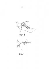 Шнурок с трубчатым телом (патент 2604179)