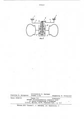 Ходовая часть транспортного средства (патент 831637)