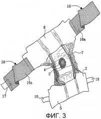 Абсорбирующее изделие, содержащее средство для кондиционирования кожи (патент 2314081)