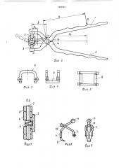 Коронкосниматель и.г.мухина (патент 1503783)