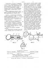Несъемный мостовидный протез (патент 1187813)