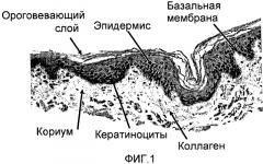 Стерильный аутологичный, аллогенный или ксеногенный имплантат и способ его изготовления (патент 2478403)