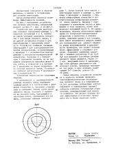 Устройство для лечения импотенции (патент 1191078)