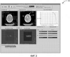 Интерактивный компьютеризованный редактор для компенсаторов, используемых в планировании лучевой терапии (патент 2571374)