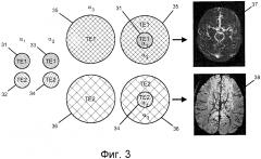 Быстрое формирование магнитно-резонансного изображения с двойной контрастностью (патент 2603598)
