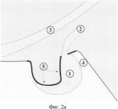 Способ прижизненной диагностики интраселлярной гипертензии на низкопольном магнитно-резонансном томографе (патент 2361512)