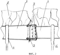 Инструмент для наложения анастомоза (патент 2515760)