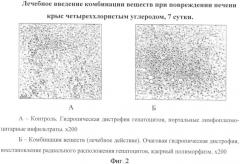 Способ уменьшения токсического повреждения печени (патент 2342132)