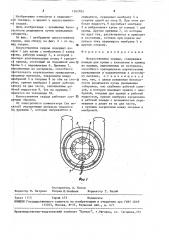 Искусственное сердце (патент 1563703)